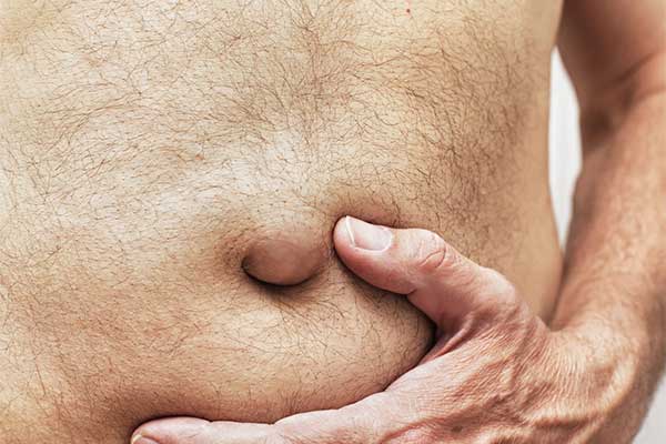 Abdominal-and-Inguinal-Hernias